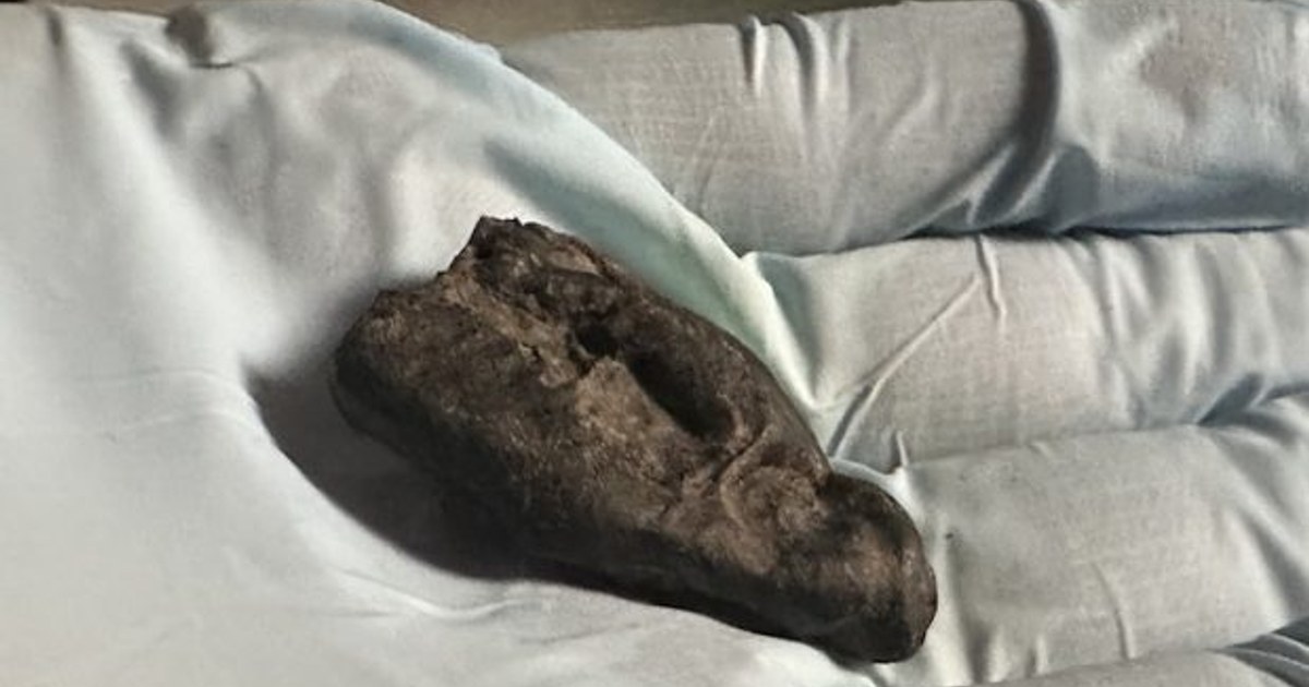 Estonya'da Huş Katranından 10.500 Yıllık 'Sakız' Bulundu