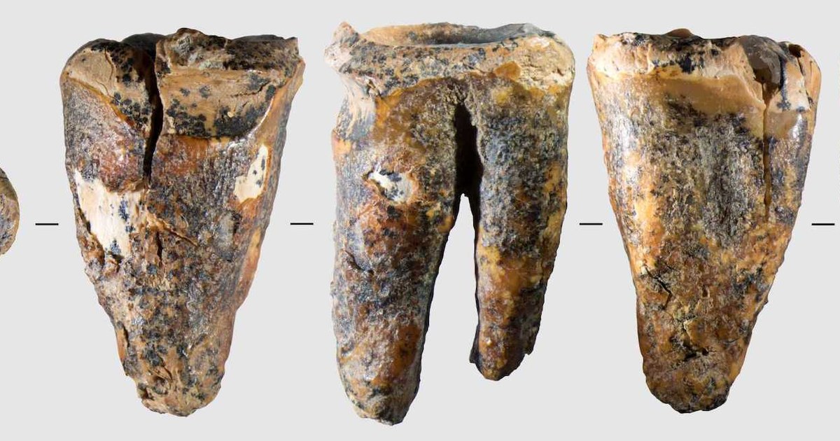 Neandertal Diş Hekimliği 60.000 Yıla Dayanıyor