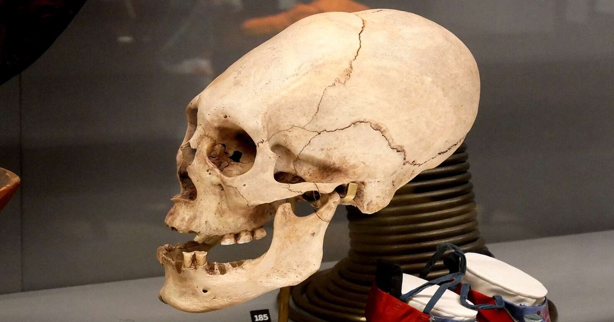 DNA Analysis of Peru's Mysterious Elongated Skulls Deepens the Mystery