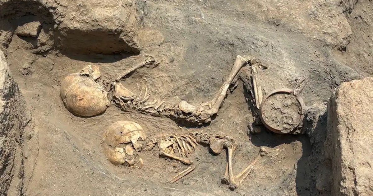 La plus ancienne chirurgie de l'Asie centrale : un crâne datant de 4 000 ans découvert en Ouzbékistan